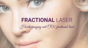 Fractional laser Nederland.